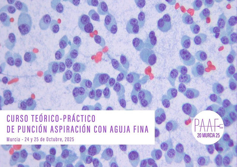 Cursos Curso teórico-práctico de punción aspiración con aguja fina - Taller de PAAF