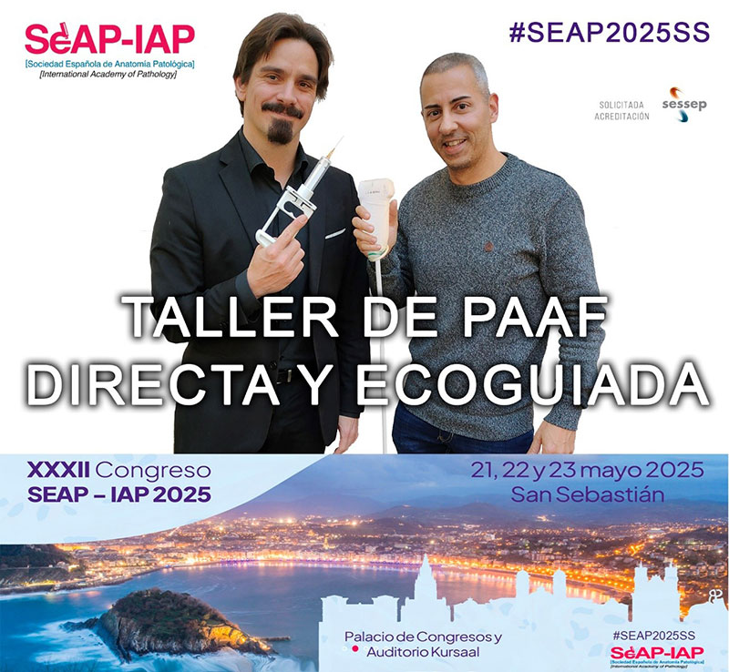 Cursos Taller de PAAF directa y ecoguiada para residentes y patólogos
